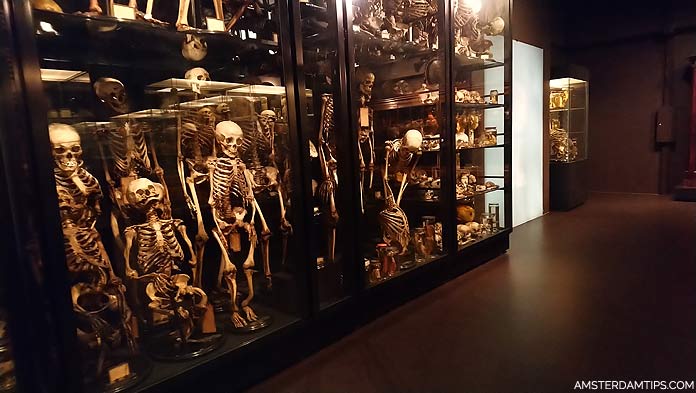 museum vrolik skeleton cabinet