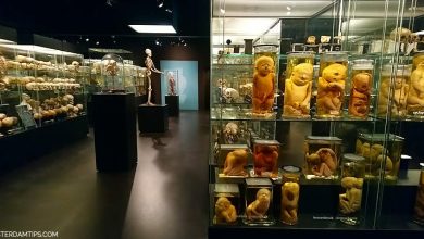 museum vrolik amsterdam